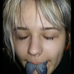 Сплит окрашенного языка. 5 дней после снятия швов. Окрашивание зажившее.